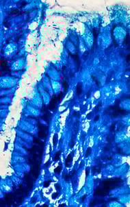 Side-Banner-image-1