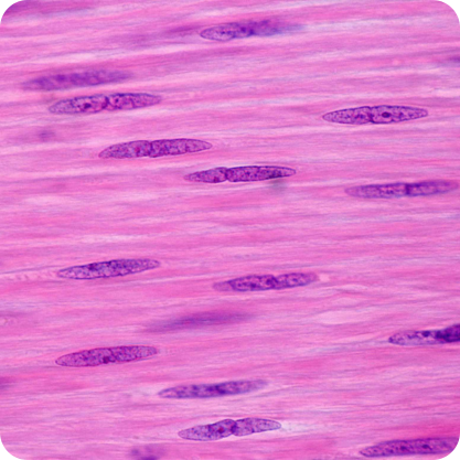 image track